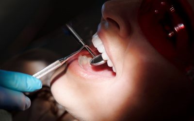 Prevenir la pérdida de piezas dentales