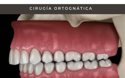 Cirugía ortognática y ortodoncia