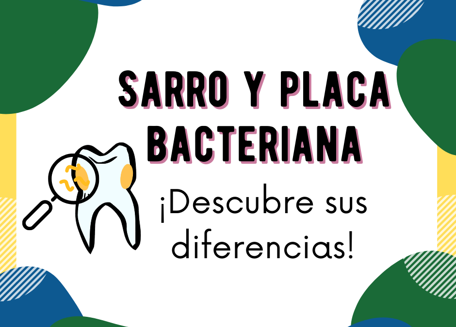 Diferencias entre el sarro y la placa bacteriana