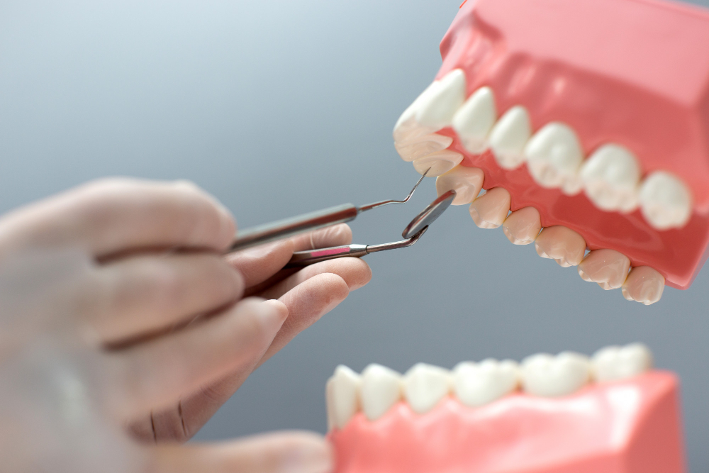 ¿Qué es la biopelícula dental?